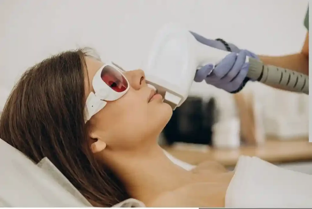 laser hair removal