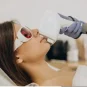 laser hair removal