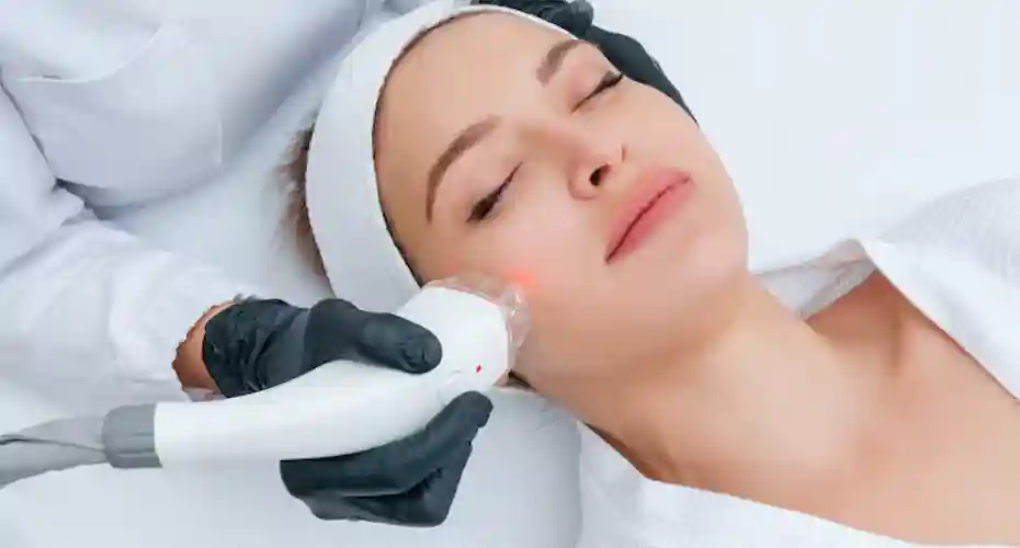 laser skin rejuvenation